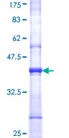 GBGT1 Protein - 12.5% SDS-PAGE Stained with Coomassie Blue.