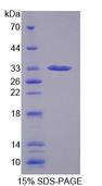GBP1 Protein - Recombinant Guanylate Binding Protein 1, Interferon Inducible (GBP1) by SDS-PAGE