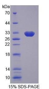 GBP2 Protein - Recombinant Guanylate Binding Protein 2, Interferon Inducible (GBP2) by SDS-PAGE