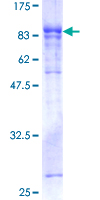 GBP5 Protein - 12.5% SDS-PAGE of human GBP5 stained with Coomassie Blue