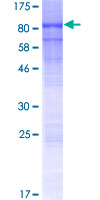 GBP6 Protein - 12.5% SDS-PAGE of human GBP6 stained with Coomassie Blue