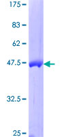 GBTS1 / DIRAS1 Protein - 12.5% SDS-PAGE of human DIRAS1 stained with Coomassie Blue