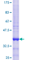 GBTS1 / DIRAS1 Protein - 12.5% SDS-PAGE Stained with Coomassie Blue.