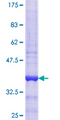GBTS1 / DIRAS1 Protein - 12.5% SDS-PAGE Stained with Coomassie Blue.