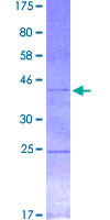 GBX2 Protein - 12.5% SDS-PAGE Stained with Coomassie Blue.
