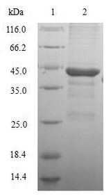 GC / Vitamin D-Binding Protein Protein - (Tris-Glycine gel) Discontinuous SDS-PAGE (reduced) with 5% enrichment gel and 15% separation gel.