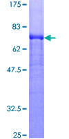 GC / Vitamin D-Binding Protein Protein - 12.5% SDS-PAGE of human GC stained with Coomassie Blue