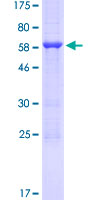 GC1qR / C1QBP Protein - 12.5% SDS-PAGE of human C1QBP stained with Coomassie Blue