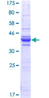 GC1qR / C1QBP Protein - 12.5% SDS-PAGE Stained with Coomassie Blue.