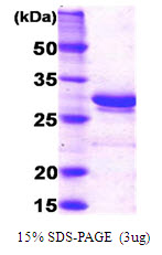 GC1qR / C1QBP Protein