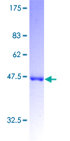 GCAP / GUCA1A Protein - 12.5% SDS-PAGE of human GUCA1A stained with Coomassie Blue