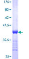 GCAP / GUCA1A Protein - 12.5% SDS-PAGE Stained with Coomassie Blue.