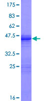 GCAP3 / GUCA1C Protein - 12.5% SDS-PAGE of human GUCA1C stained with Coomassie Blue