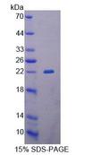 GCD / GCDH Protein - Recombinant Glutaryl Coenzyme A Dehydrogenase (GCDH) by SDS-PAGE