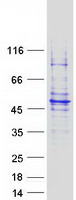 GCD / GCDH Protein - Purified recombinant protein GCDH was analyzed by SDS-PAGE gel and Coomassie Blue Staining