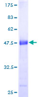 GCET2 / HGAL Protein - 12.5% SDS-PAGE of human GCET2 stained with Coomassie Blue