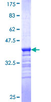 GCET2 / HGAL Protein