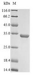 GCG / Glucagon Protein - (Tris-Glycine gel) Discontinuous SDS-PAGE (reduced) with 5% enrichment gel and 15% separation gel.