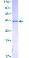 GCG / Glucagon Protein - 12.5% SDS-PAGE of human GCG stained with Coomassie Blue