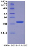 GCG / Glucagon Protein - Recombinant Glucagon By SDS-PAGE
