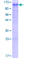 GCK / Germinal Center Kinase Protein - 12.5% SDS-PAGE of human MAP4K2 stained with Coomassie Blue