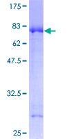 GCK / Glucokinase Protein - 12.5% SDS-PAGE of human GCK stained with Coomassie Blue