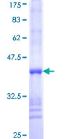 GCK / Glucokinase Protein - 12.5% SDS-PAGE Stained with Coomassie Blue.