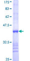 GCK / Glucokinase Protein - 12.5% SDS-PAGE Stained with Coomassie Blue.