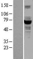 GCKR Protein - Western validation with an anti-DDK antibody * L: Control HEK293 lysate R: Over-expression lysate