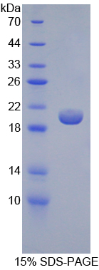 GCKR Protein - Recombinant Glucokinase Regulatory Protein By SDS-PAGE