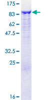 GCLC Protein - 12.5% SDS-PAGE of human GCLC stained with Coomassie Blue