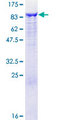 GCLC Protein - 12.5% SDS-PAGE of human GCLC stained with Coomassie Blue