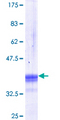 GCLC Protein - 12.5% SDS-PAGE Stained with Coomassie Blue.