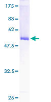 GCLM Protein - 12.5% SDS-PAGE of human GCLM stained with Coomassie Blue