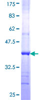 GCN2 Protein - 12.5% SDS-PAGE Stained with Coomassie Blue.