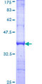GCN2 Protein - 12.5% SDS-PAGE Stained with Coomassie Blue.