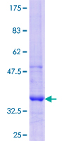 GCNT3 Protein - 12.5% SDS-PAGE Stained with Coomassie Blue.