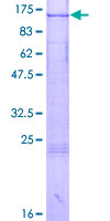 GCP3 / TUBGCP3 Protein - 12.5% SDS-PAGE of human TUBGCP3 stained with Coomassie Blue