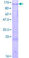 GCP3 / TUBGCP3 Protein - 12.5% SDS-PAGE of human TUBGCP3 stained with Coomassie Blue