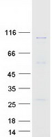 GCP3 / TUBGCP3 Protein - Purified recombinant protein TUBGCP3 was analyzed by SDS-PAGE gel and Coomassie Blue Staining
