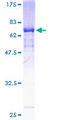 GDA / Nedasin Protein - 12.5% SDS-PAGE of human GDA stained with Coomassie Blue
