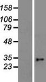 GDAP1 Protein - Western validation with an anti-DDK antibody * L: Control HEK293 lysate R: Over-expression lysate