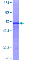 GDAP1 Protein - 12.5% SDS-PAGE of human GDAP1 stained with Coomassie Blue