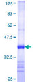 GDAP1 Protein - 12.5% SDS-PAGE Stained with Coomassie Blue.