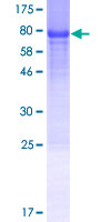 GDAP2 Protein - 12.5% SDS-PAGE of human GDAP2 stained with Coomassie Blue