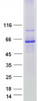 GDAP2 Protein - Purified recombinant protein GDAP2 was analyzed by SDS-PAGE gel and Coomassie Blue Staining