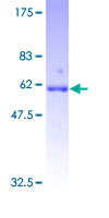 GDF10 / BMP3B Protein - 12.5% SDS-PAGE of human GDF10 stained with Coomassie Blue