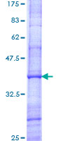GDF10 / BMP3B Protein - 12.5% SDS-PAGE Stained with Coomassie Blue.