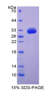 GDF11 / GDF-11 Protein - Recombinant Growth Differentiation Factor 11 By SDS-PAGE
