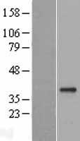 GDF15 Protein - Western validation with an anti-DDK antibody * L: Control HEK293 lysate R: Over-expression lysate